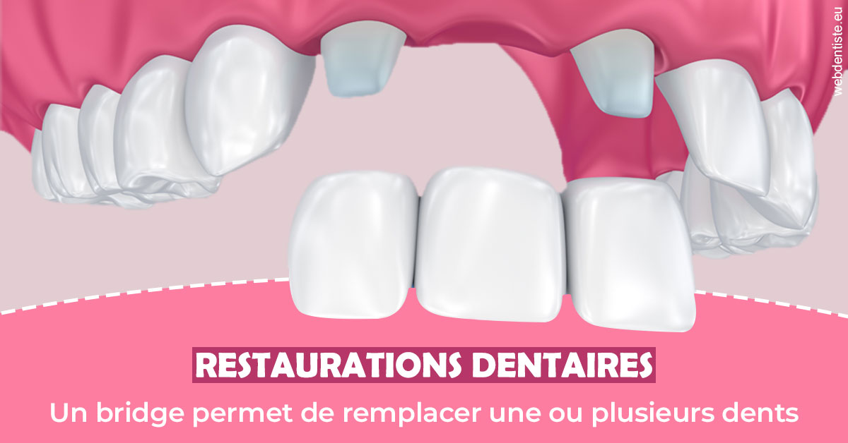 https://docteur-caroline-barnoin.chirurgiens-dentistes.fr/Bridge remplacer dents 2