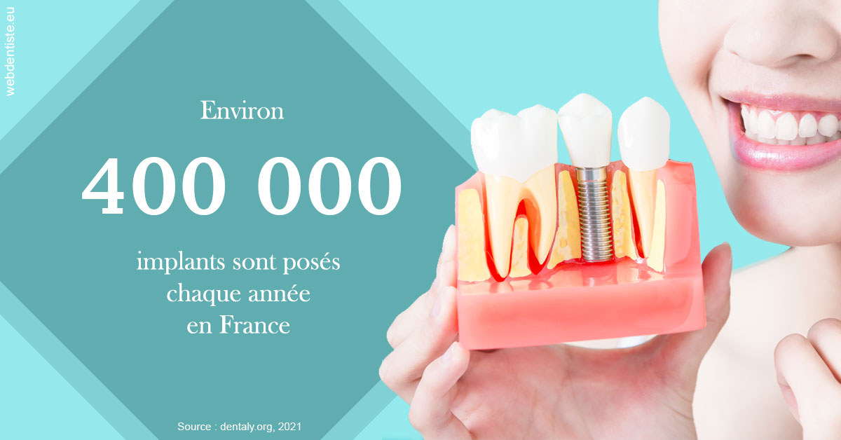 https://docteur-caroline-barnoin.chirurgiens-dentistes.fr/Pose d'implants en France 2