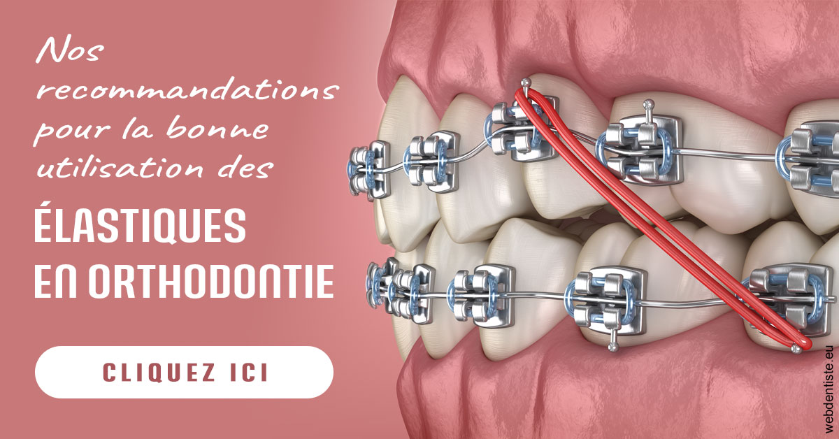 https://docteur-caroline-barnoin.chirurgiens-dentistes.fr/Elastiques orthodontie 2